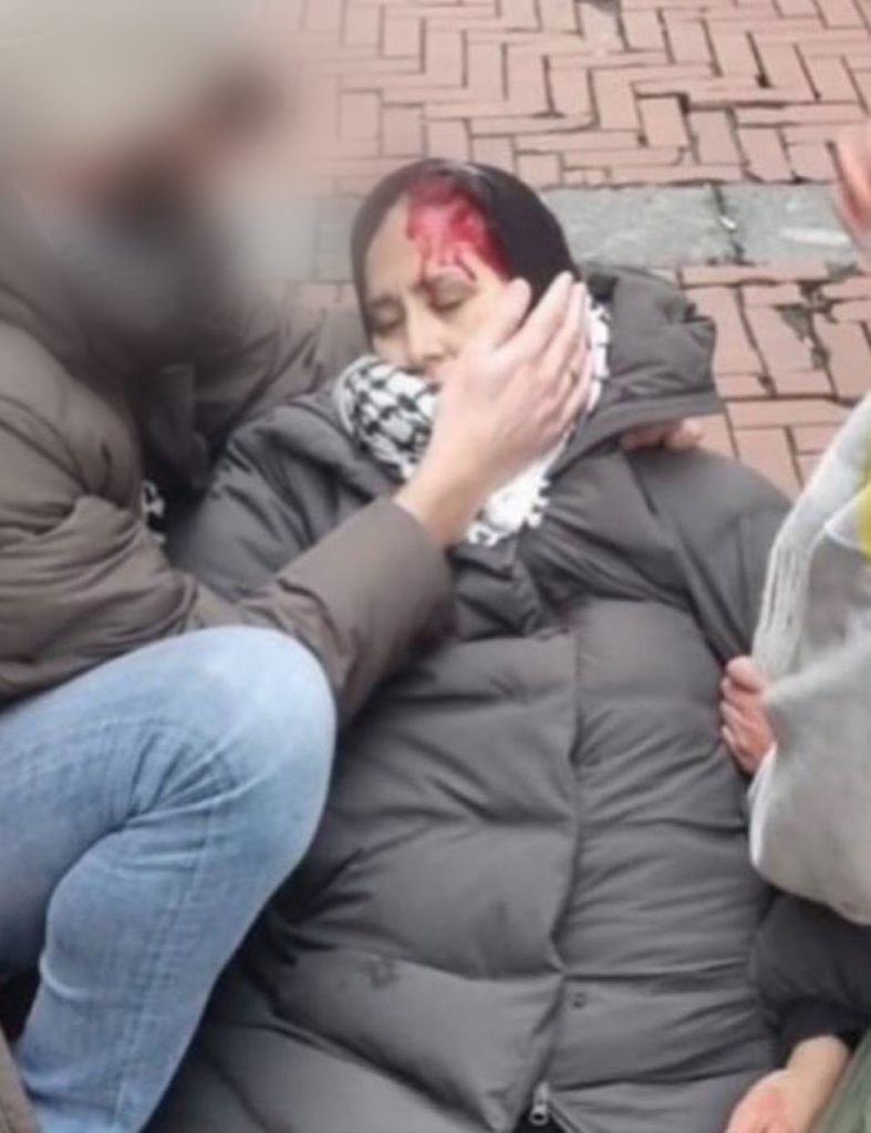 Moslima niet gevallen, maar door politie geslagen